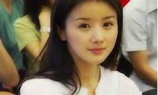 孙菲菲演员整容前后